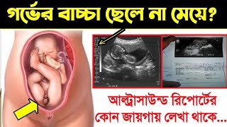 আল্ট্রাসাউন্ড রিপোর্ট দেখে কিভাবে বুঝবেন গর্ভের বাচ্চা ছেলে না মেয়ে  আল্ট্রাসনোগ্রাফি রিপোর্ট [upl. by Outhe651]