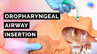 Oropharyngeal Airway Insertion  Guedel  OPA  ABCDE Emergency  OSCE Guide  UKMLA  CPSA [upl. by Ojytteb]