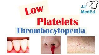 Thrombocytopenia  Signs and Symptoms and Approach to Causes [upl. by Annetta579]