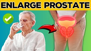 Discover 7 Proven Tips to Say Goodbye Enlarged Prostate  Health Journey [upl. by Munafo]