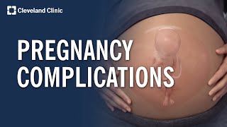 Common Pregnancy Complications Explained [upl. by Cataldo]