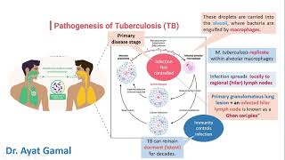 General signs amp symptoms of TB In brief for dentists [upl. by Vannie]