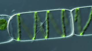 The Nucleus of Spirogyra Synedra [upl. by Erodroeht]