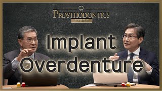 PROSTHODONTICS ON FRIDAY Implant Overdenture [upl. by Reisfield]