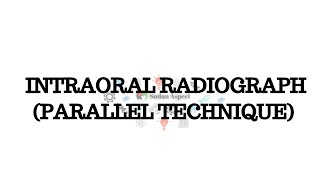 Intraoral Radiograph Parallel technique [upl. by Aniale181]