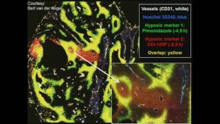 SRSSBRT  Radiobiology of High Dose Per Fraction  By Michael Joiner PhD [upl. by Terryn699]