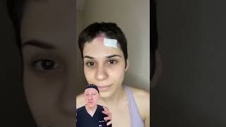 Incredible Before And After Results For Facial Melanoma  Doctor Reacts [upl. by Verney]