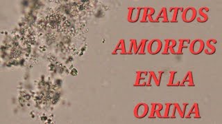 🔥 URATOS AMORFOS EN LA ORINA 🔥 [upl. by Alexandrina]