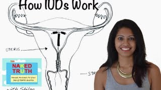 How an IUD Works  Episode 18 [upl. by Laforge729]