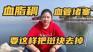 血脂稠血管堵塞严重，子睿教你这样去掉，防止脑梗脑出血 [upl. by Dent368]