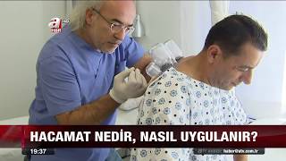 ATV Haber Kliniğimize Konuk Oldu  DR TURANŞAH TÜMER ANLATIYOR [upl. by Asetal129]