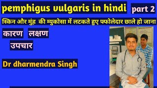 pemphigus vulgaris in hindi  pemphigus vulgaris treatment  pemphigus vulgaris symptoms  causes [upl. by Granese]