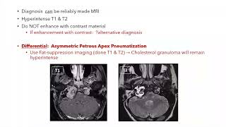 Petrous apex lesions [upl. by Elyl369]