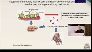 IRACON 2022  CLASSIC SESSION ON RHEUMATOID ARTHRITIS  25NOV2022  DR BRIGADIER HALL  04200615 [upl. by Lebna]