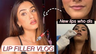 I GOT LIP FILLER 💉 05 ml Before and After VLOG [upl. by Aneala]