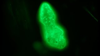 Acridine orange staining for fluorescence  first attempt [upl. by Stich]