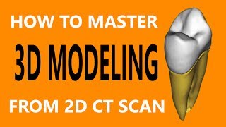 Mimics Tutorial │ Episode 1 Segmentation Of Premolar Tooth [upl. by Thema]