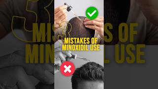 Minoxidil Biggest Mistakes  Don’t Do It Please minoxidil [upl. by Marlen]