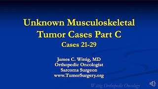 Orthopedic Oncology Course  Unknown Test Cases Part C Cases 2129  Lecture 13 [upl. by Sisxela]