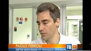 Paolo Ferroli neurochirurgo dell istituto Besta di Milano [upl. by Goulder]