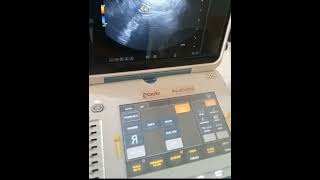 Esaote Mylab Gamma TVS pregnancy ultrasound medicalequipment [upl. by Laurie]