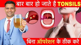 बिना Operation के Tonsils घर में ठीक करें  Tonsillitis Home Remedies [upl. by Crowe733]