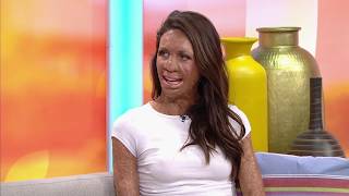 Turia Pitt on her passion for motherhood and life [upl. by Ytoc]