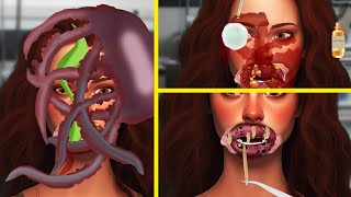 ASMR Lips Sting  Swollen Lips By Jellyfish Sting SATISFYING Treatment Animation  ASMR Derm [upl. by Ysteb574]