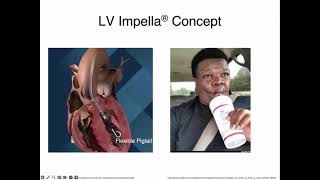 Impella What the Intensivist Needs to Know  Part 1 [upl. by Ilek]