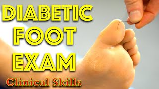 Diabetic Foot Examination  Clinical Skills  Dr Gill [upl. by Bailar]