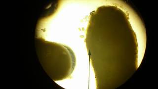 Tapeworm segment releasing eggs [upl. by Araz640]