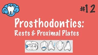 Prosthodontics  Rests amp Proximal Plates  INBDE ADAT [upl. by Netloc774]