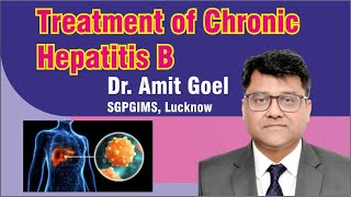 Treatment of Chronic Hepatitis B Dr Amit Goel SGPGIMS Lucknow [upl. by Averyl913]