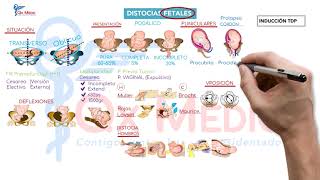 Ficha resumen Obstetricia Distocias fetales ENAMENARMSERUMS [upl. by Ominorej]