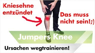 2 Übungen bei Jumpers Knee  Schmerzen unterhalb der Kniescheibe [upl. by Asare]