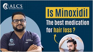 How Minoxidil Reduces Hair Loss and Strengthens Hair  ALCS Clinic with Dr Sunil Arora [upl. by Alexandria]