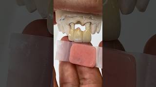 Zirconia Bridge with minimal Pink Porcelain lsk121shorts dental teeth [upl. by Aviva]