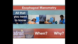 Esophageal Manometry Know when and why it is needed  Ahmedabad Gujarat INDIA [upl. by Eissolf]