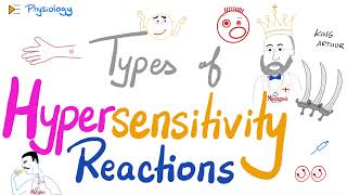 Hypersensitivity Reactions Type I II III IV HSN  Most Comprehensive Explanation [upl. by Feola]