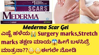 Mederma Scar Gel Review in kannadaUsesside effectssafety Advice surgeryrecovery stretchmarks [upl. by Maffei]