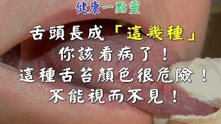 如果舌頭長成「這幾種」樣子，你就該看病了！尤其這種舌苔顏色很危險！不能視而不見！ 健康一點靈 [upl. by Nimzay]