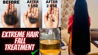 Hair fall treatment at home  💯 results home remedy ​⁠Zonnilifestyle [upl. by Addiego]