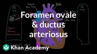 Foramen ovale and ductus arteriosus  Circulatory system physiology  NCLEXRN  Khan Academy [upl. by Ennairod130]