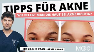 Was hilft gegen Akne [upl. by Drescher]