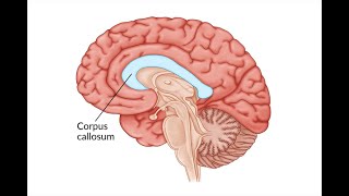 Section of the corpus Callosum and effect on left and right visual field [upl. by Atiker]