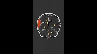 Brain Herniation Syndromes [upl. by Oirromed]