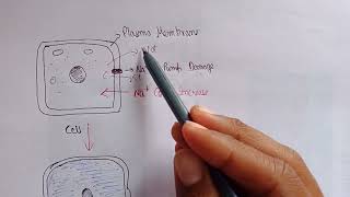 hydropic change in cell  hydropic change pathophysiology  cell swelling [upl. by Anavlys507]