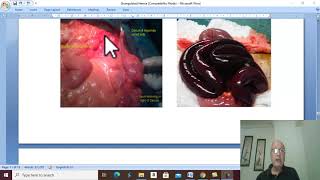 Hernia in Arabic 8  Strangulated hernia  part 3  by DrWahdan [upl. by Woodley67]