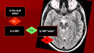 Introduction to Imaging What am I looking at [upl. by Inus]