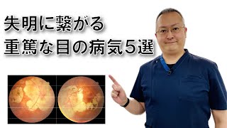 放置すると失明に繋がる重篤な目の病気５選 [upl. by Daley46]